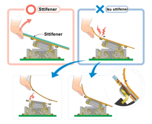 mechanical support