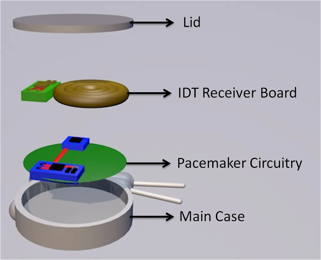 pacemaker components