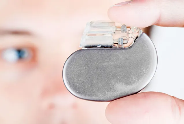 Pacemaker device with internal PCB for medical applications."