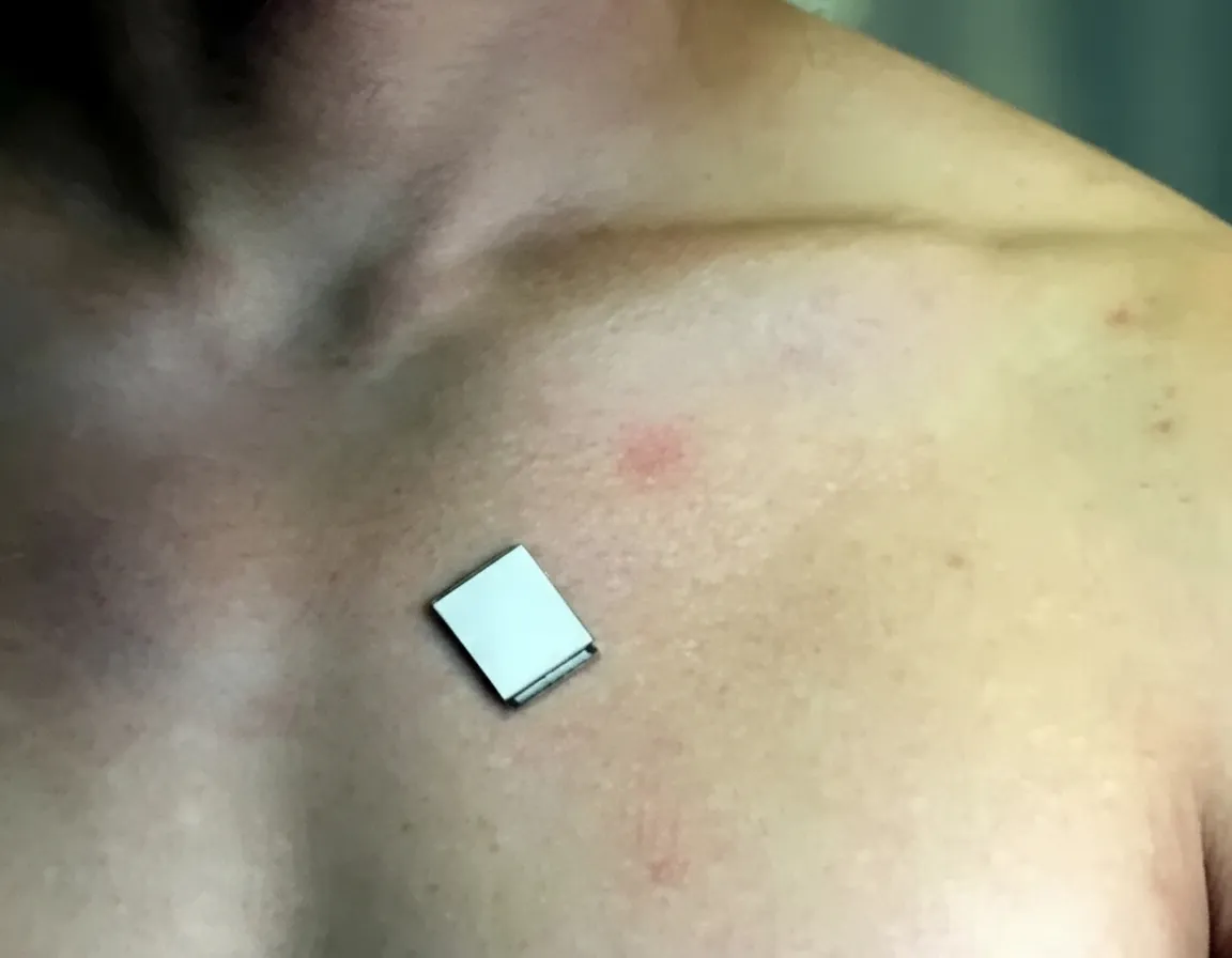wearable ultrasound imaging sensor